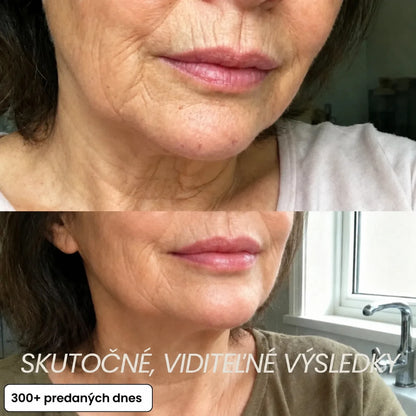Vypĺňací stick Bio-Kolagén PDRN