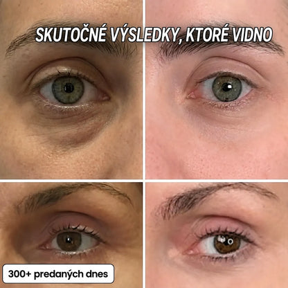 Vypĺňací stick Bio-Kolagén PDRN