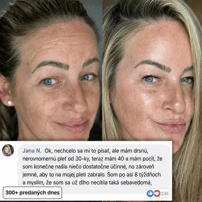Vypĺňací stick Bio-Kolagén PDRN